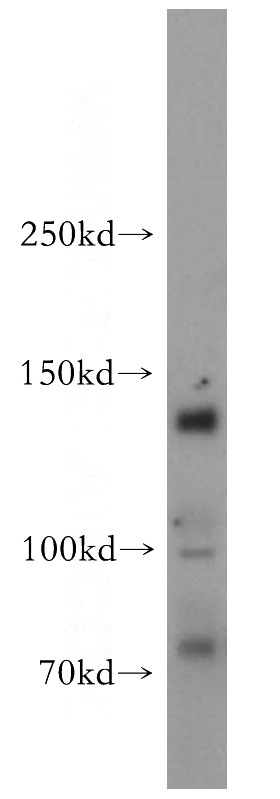 K-562 cells were subjected to SDS PAGE followed by western blot with Catalog No:112687(MLXIP antibody) at dilution of 1:500