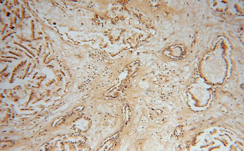 Immunohistochemical of paraffin-embedded human prostate using Catalog No:113249(NME5 antibody) at dilution of 1:100 (under 10x lens)