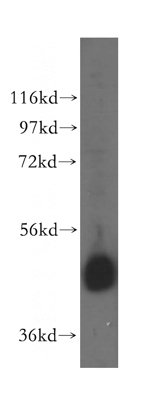 A549 cells were subjected to SDS PAGE followed by western blot with Catalog No:110257(EIF4A3 antibody) at dilution of 1:600