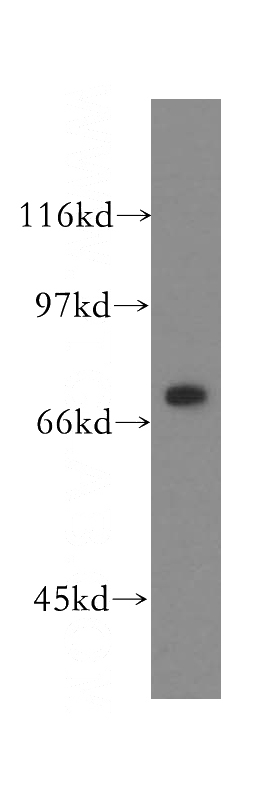 HEK-293 cells were subjected to SDS PAGE followed by western blot with Catalog No:111760(IMP5 antibody) at dilution of 1:500