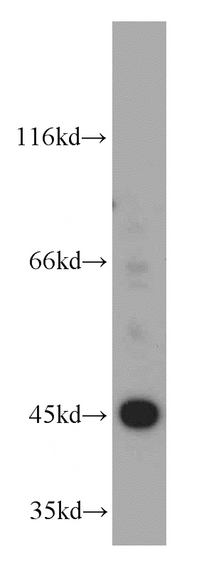 HeLa cells were subjected to SDS PAGE followed by western blot with Catalog No:110229(EI24 antibody) at dilution of 1:600