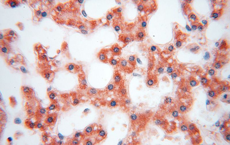 Immunohistochemical of paraffin-embedded human liver using Catalog No:113895(PIGO antibody) at dilution of 1:100 (under 40x lens)