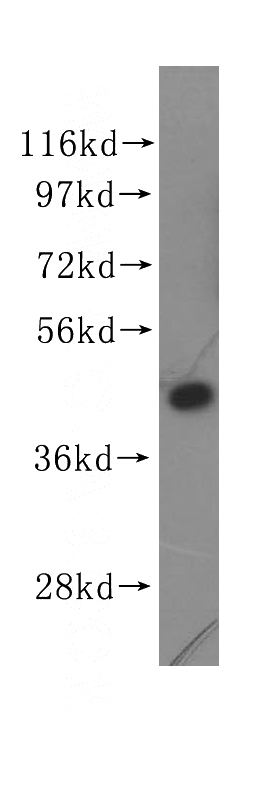 Jurkat cells were subjected to SDS PAGE followed by western blot with Catalog No:110202(EIF4A2 antibody) at dilution of 1:400