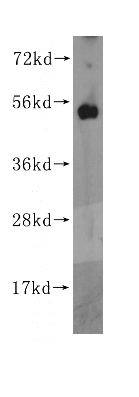 mouse ovary tissue were subjected to SDS PAGE followed by western blot with Catalog No:113422(ORC5L antibody) at dilution of 1:400