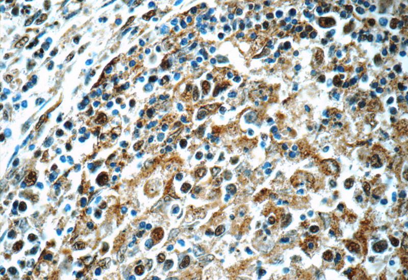 Immunohistochemistry of paraffin-embedded human spleen tissue slide using Catalog No:112550(Mcl-1l--specific Antibody) at dilution of 1:50 (under 40x lens)