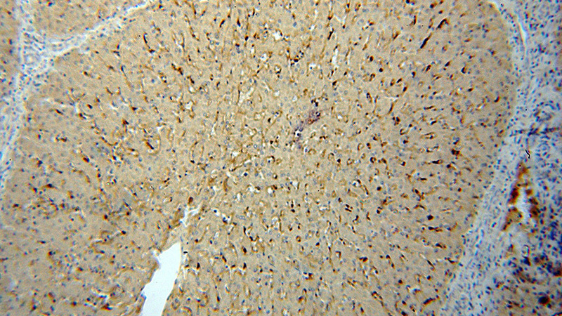 Immunohistochemical of paraffin-embedded human liver using Catalog No:109006(MRC1 antibody) at dilution of 1:100 (under 10x lens)