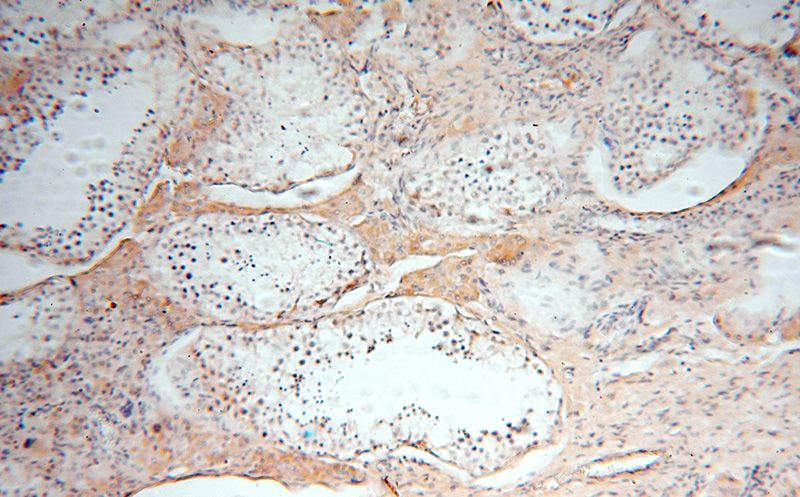 Immunohistochemical of paraffin-embedded human testis using Catalog No:113082(NDUFS3 antibody) at dilution of 1:50 (under 10x lens)