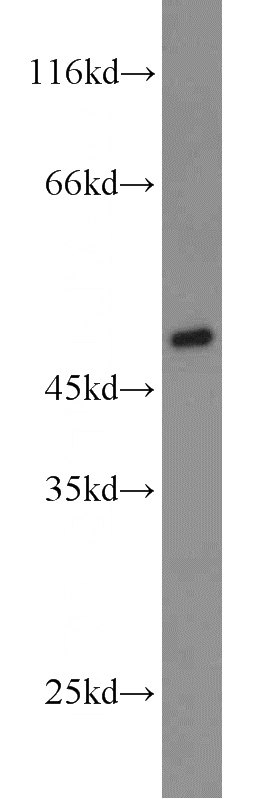 A2780 cells were subjected to SDS PAGE followed by western blot with Catalog No:117195(BMP15 antibody) at dilution of 1:300