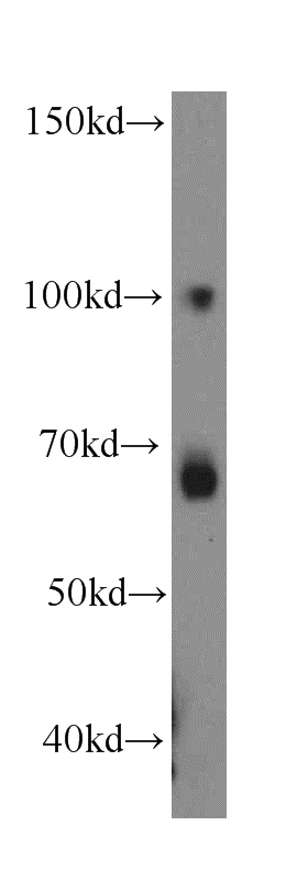 HT-1080 cells were subjected to SDS PAGE followed by western blot with Catalog No:112304(LPIN2 antibody) at dilution of 1:300