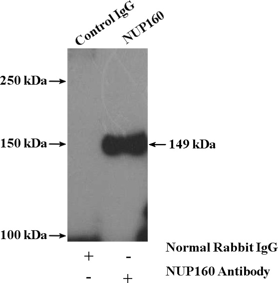 IP Result of anti-NUP160 (IP:Catalog No:113376, 4ug; Detection:Catalog No:113376 1:500) with HeLa cells lysate 4000ug.