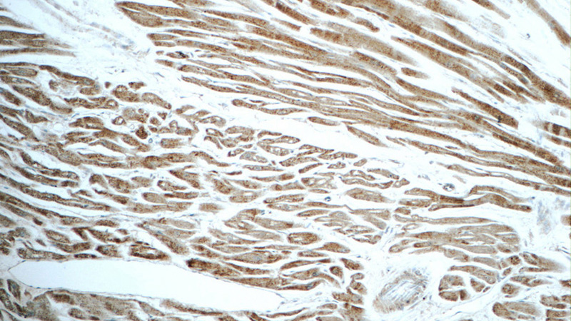 Immunohistochemistry of paraffin-embedded human heart tissue slide using Catalog No:112547(MCHR1 Antibody) at dilution of 1:50 (under 10x lens)