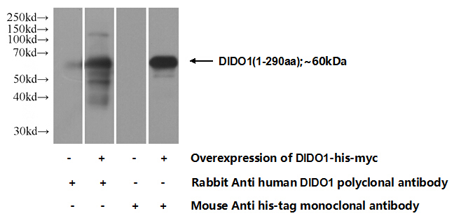Transfected HEK-293 cells were subjected to SDS PAGE followed by western blot with Catalog No:109940(DIDO1 Antibody) at dilution of 1:1000