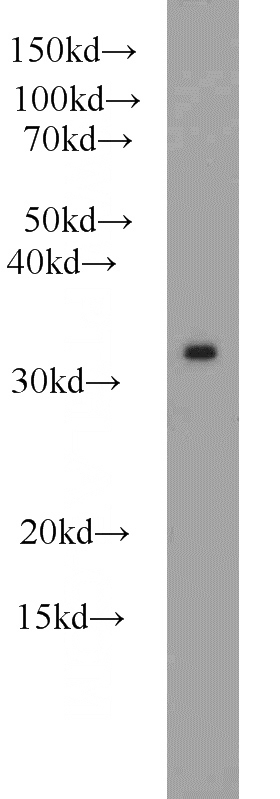 COLO 320 cells were subjected to SDS PAGE followed by western blot with Catalog No:114372(PSMA1 antibody) at dilution of 1:600