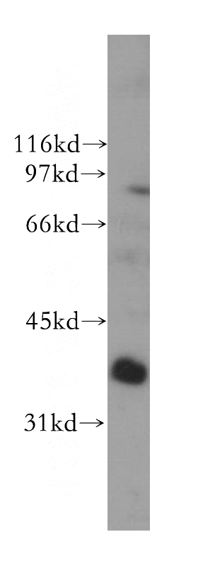 human liver tissue were subjected to SDS PAGE followed by western blot with Catalog No:114272(PTGR1 antibody) at dilution of 1:500