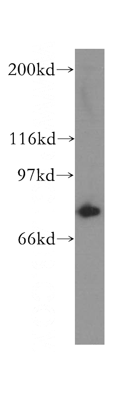 Y79 cells were subjected to SDS PAGE followed by western blot with Catalog No:109370(COG7 antibody) at dilution of 1:400