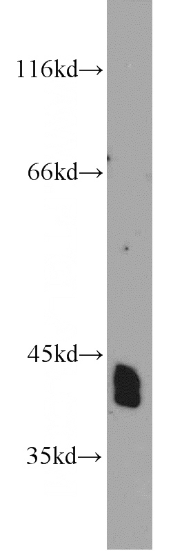 rat brain tissue were subjected to SDS PAGE followed by western blot with Catalog No:113057(NDRG2 antibody) at dilution of 1:1000