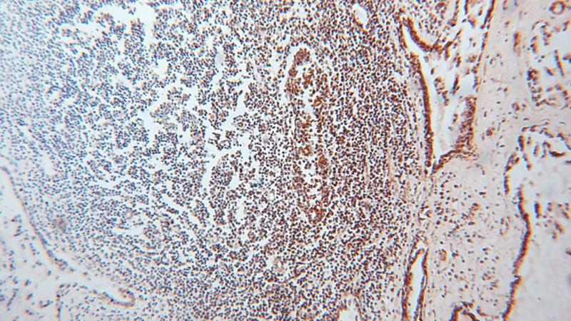 Immunohistochemical of paraffin-embedded human prostate using Catalog No:113087(NDUFV2 antibody) at dilution of 1:50 (under 10x lens)