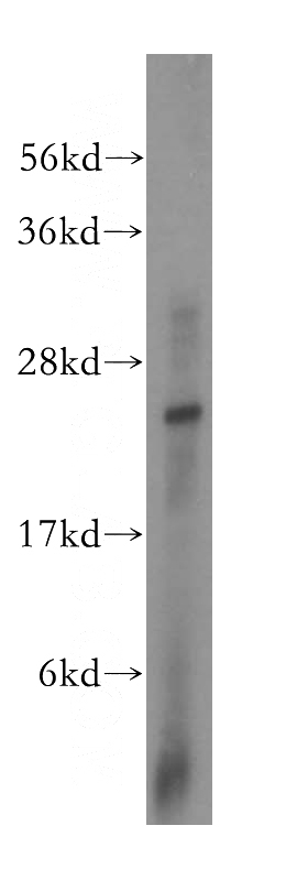 PC-3 cells were subjected to SDS PAGE followed by western blot with Catalog No:112520(METTL5 antibody) at dilution of 1:800