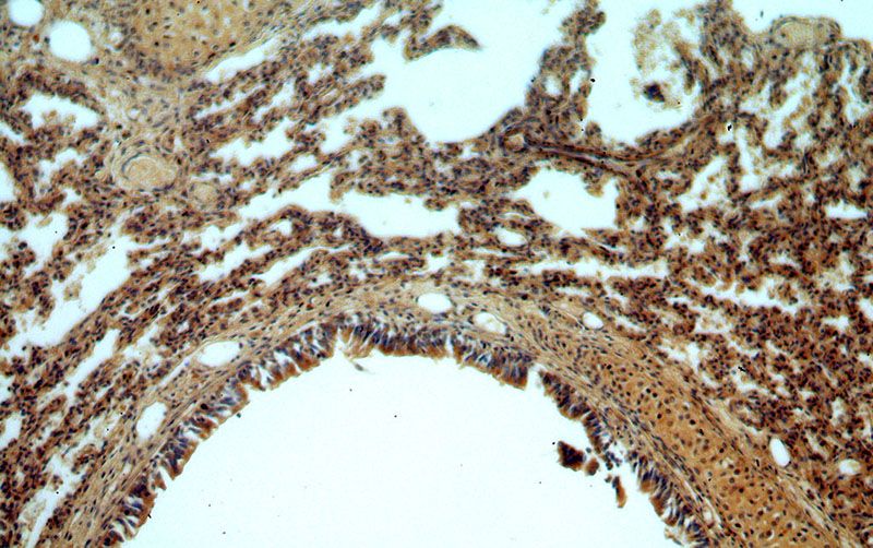 Immunohistochemical of paraffin-embedded human lung using Catalog No:117092(B3GNT5 antibody) at dilution of 1:50 (under 10x lens)