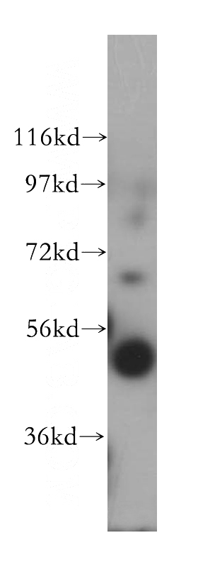 human colon tissue were subjected to SDS PAGE followed by western blot with Catalog No:117186(BLMH antibody) at dilution of 1:600