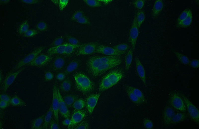 Immunofluorescent analysis of HeLa cells using Catalog No:107230(KRT15 Antibody) at dilution of 1:25 and Alexa Fluor 488-congugated AffiniPure Goat Anti-Mouse IgG(H+L)
