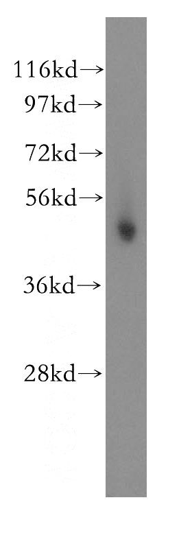 human skeletal muscle tissue were subjected to SDS PAGE followed by western blot with Catalog No:114391(PSMC4 antibody) at dilution of 1:500