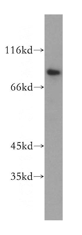 human skeletal muscle tissue were subjected to SDS PAGE followed by western blot with Catalog No:112284(LMOD1 antibody) at dilution of 1:300
