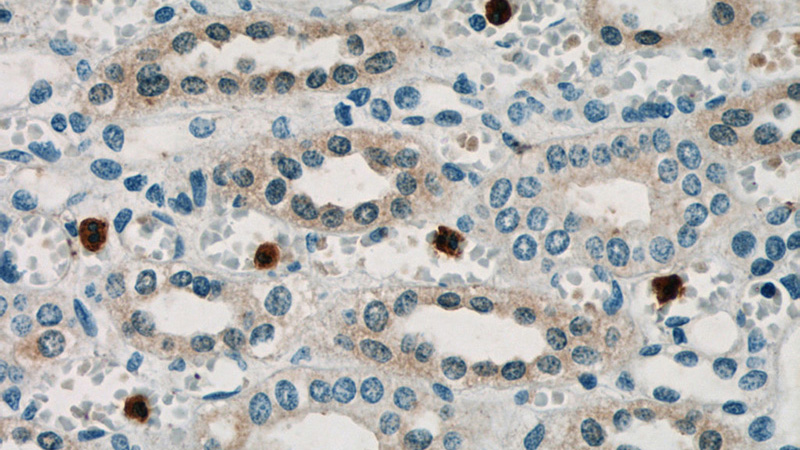 Immunohistochemistry of paraffin-embedded human kidney slide using Catalog No:116302(TRIM2 Antibody) at dilution of 1:50(under 40x lens)