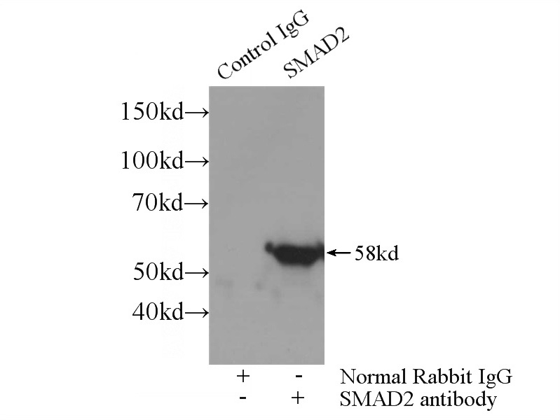 IP Result of anti-SMAD2 (IP:Catalog No:115416, 3ug; Detection:Catalog No:115416 1:1000) with HepG2 cells lysate 3000ug.