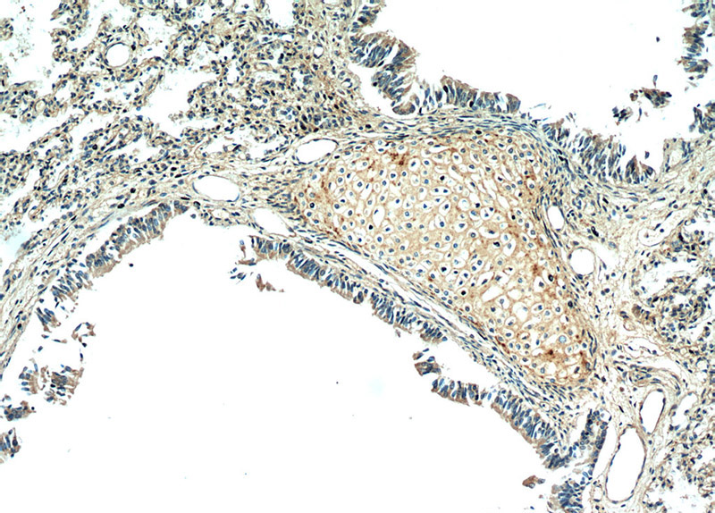 Immunohistochemical of paraffin-embedded human lung using Catalog No:107425(MGP antibody) at dilution of 1:50 (under 10x lens)