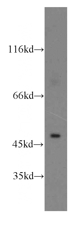 MCF7 cells were subjected to SDS PAGE followed by western blot with Catalog No:109718(CTBS antibody) at dilution of 1:400