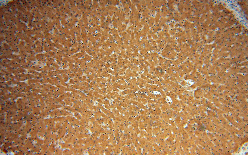 Immunohistochemical of paraffin-embedded human liver using Catalog No:110009(DPYS antibody) at dilution of 1:50 (under 10x lens)
