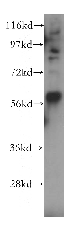 mouse brain tissue were subjected to SDS PAGE followed by western blot with Catalog No:112302(LPCAT4 antibody) at dilution of 1:500