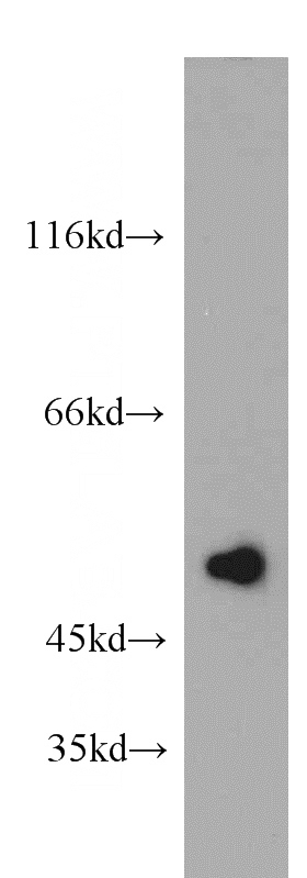 HepG2 cells were subjected to SDS PAGE followed by western blot with Catalog No:116145(TNIP2 antibody) at dilution of 1:500
