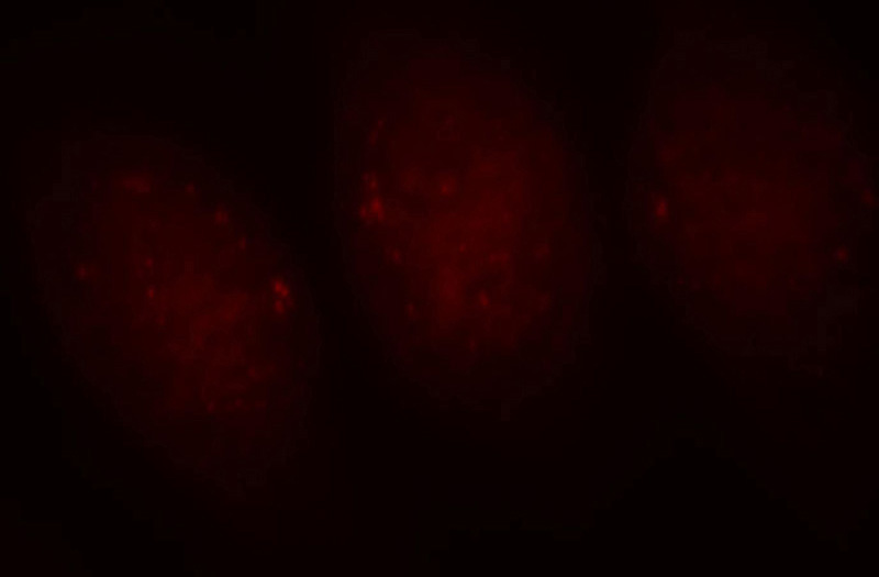 Immunofluorescent analysis of Hela cells, using PPIG antibody Catalog No:114125 at 1:25 dilution and Rhodamine-labeled goat anti-rabbit IgG (red).