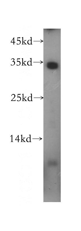 HepG2 cells were subjected to SDS PAGE followed by western blot with Catalog No:112742(MPG antibody) at dilution of 1:100