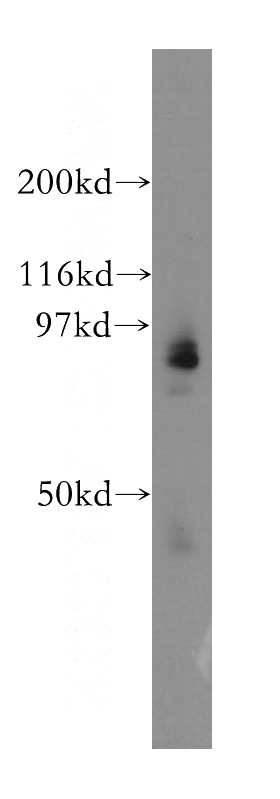 A2780 cells were subjected to SDS PAGE followed by western blot with Catalog No:112194(LENG8 antibody) at dilution of 1:1200