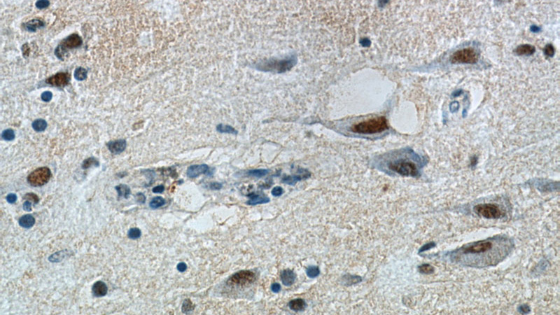 Immunohistochemical of paraffin-embedded human brain using Catalog No:115144(SFPQ antibody) at dilution of 1:50 (under 40x lens)