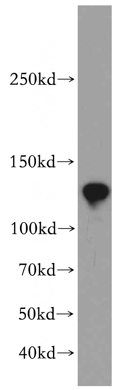 mouse testis tissue were subjected to SDS PAGE followed by western blot with Catalog No:108966(CCDC158 antibody) at dilution of 1:500
