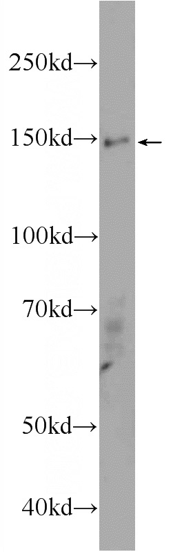 HepG2 cells were subjected to SDS PAGE followed by western blot with Catalog No:108273(ASTN2 Antibody) at dilution of 1:300