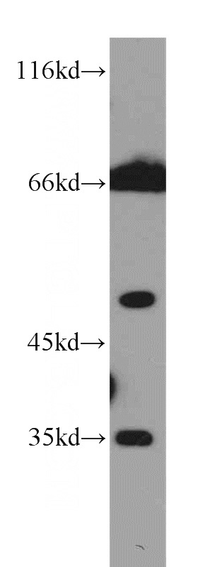 K-562 cells were subjected to SDS PAGE followed by western blot with Catalog No:109293(CHST12 antibody) at dilution of 1:1000
