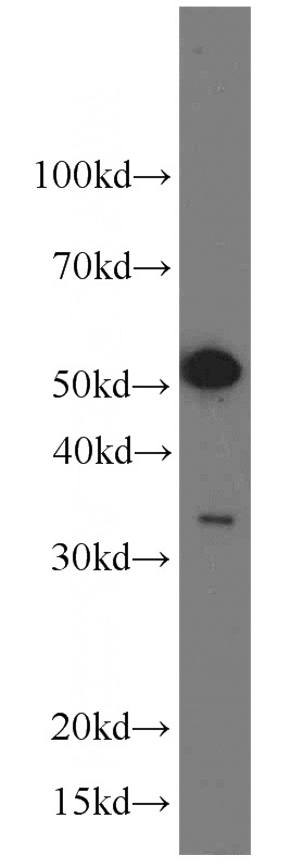 HeLa cells were subjected to SDS PAGE followed by western blot with Catalog No:108406(BAG1 antibody) at dilution of 1:500