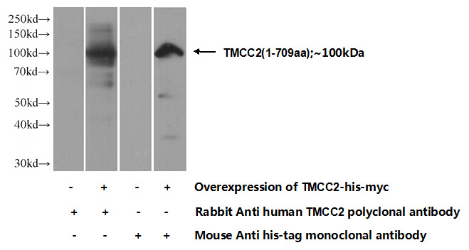 Transfected HEK-293 cells were subjected to SDS PAGE followed by western blot with Catalog No:116083(TMCC2 Antibody) at dilution of 1:1000
