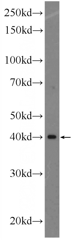 COLO 320 cells were subjected to SDS PAGE followed by western blot with Catalog No:112191(LEF1 Antibody) at dilution of 1:300