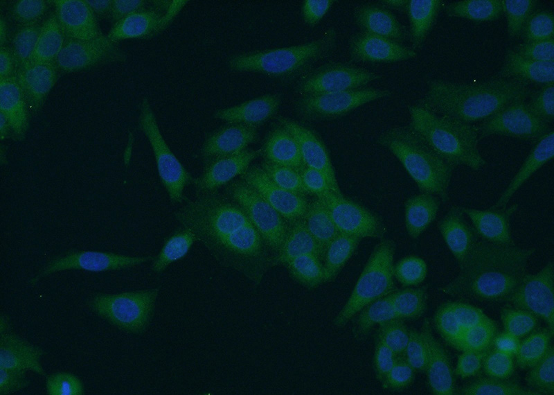 Immunofluorescent analysis of HeLa cells using Catalog No:114996(SCHIP1 Antibody) at dilution of 1:50 and Alexa Fluor 488-congugated AffiniPure Goat Anti-Rabbit IgG(H+L)