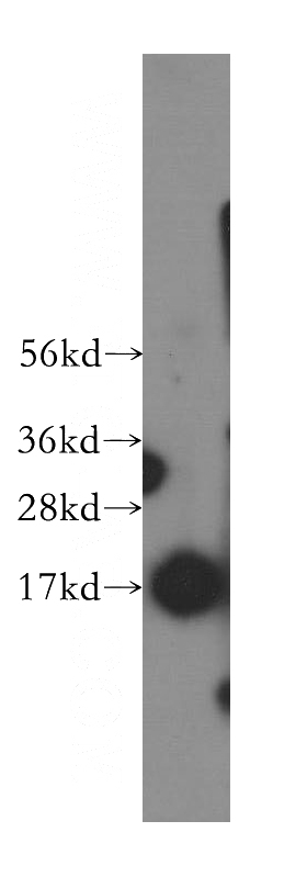 A375 cells were subjected to SDS PAGE followed by western blot with Catalog No:115606(SSBP1 antibody) at dilution of 1:500