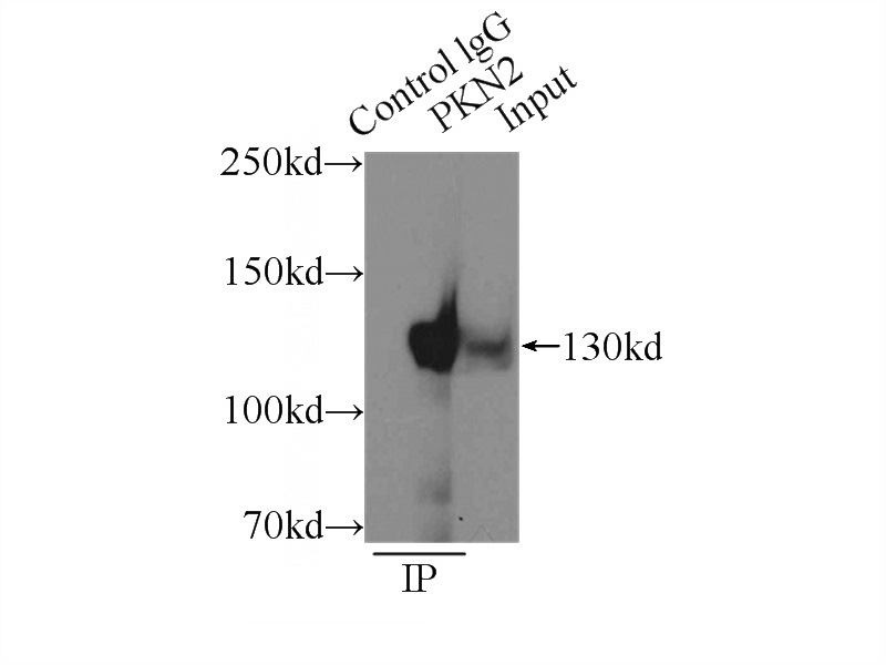 IP Result of anti-PKN2 (IP:Catalog No:113919, 3ug; Detection:Catalog No:113919 1:1000) with COLO 320 cells lysate 2500ug.
