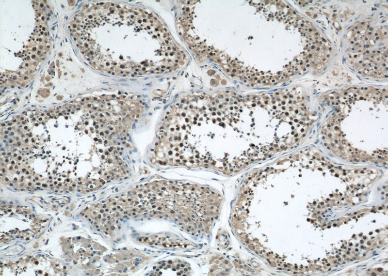 Immunohistochemical of paraffin-embedded human testis using Catalog No:110517(FANCD2 antibody) at dilution of 1:50 (under 10x lens)