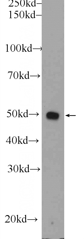 mouse liver tissue were subjected to SDS PAGE followed by western blot with Catalog No:114243(PSMD5 Antibody) at dilution of 1:1000