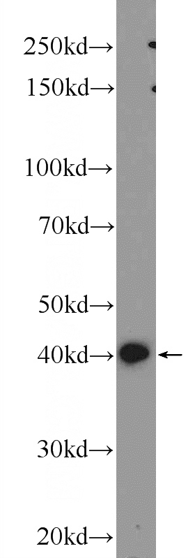 C6 cells were subjected to SDS PAGE followed by western blot with Catalog No:111687(IGFBP4 Antibody) at dilution of 1:600